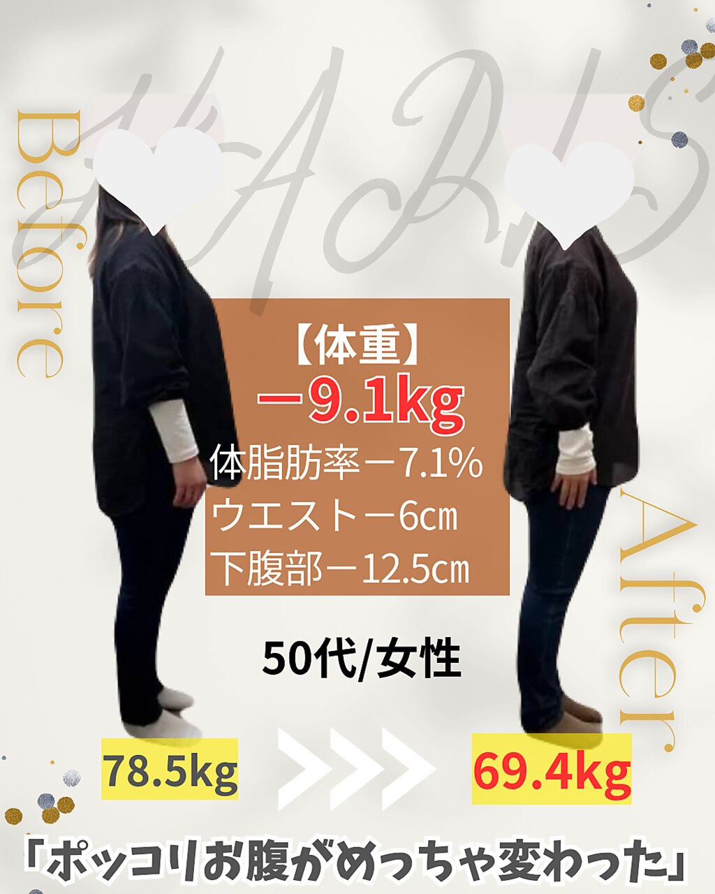 育毛促進鍼体験